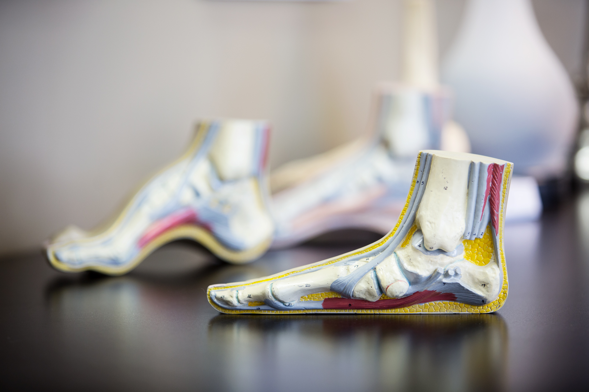 Physician models of feet help people with diabetes understand the impact of the disease on blood flow to their lower limbs. (Megan Wood, inewsource)